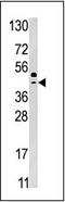 Selenophosphate Synthetase 2 antibody, AP13853PU-N, Origene, Western Blot image 