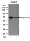 RELB Proto-Oncogene, NF-KB Subunit antibody, GTX50283, GeneTex, Western Blot image 