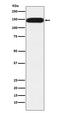 Pumilio RNA Binding Family Member 1 antibody, M02111-1, Boster Biological Technology, Western Blot image 