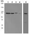 Menin 1 antibody, ab92443, Abcam, Western Blot image 