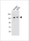 Tectonin Beta-Propeller Repeat Containing 1 antibody, A11073, Boster Biological Technology, Western Blot image 