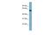 Alanine--Glyoxylate Aminotransferase 2 antibody, GTX46154, GeneTex, Western Blot image 