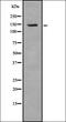 Tyrosine Aminotransferase antibody, orb337293, Biorbyt, Western Blot image 