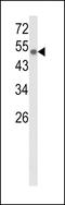 Prostaglandin I2 Synthase antibody, LS-C167246, Lifespan Biosciences, Western Blot image 