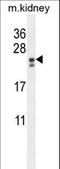 Phosphatidylinositol Glycan Anchor Biosynthesis Class X antibody, LS-C163721, Lifespan Biosciences, Western Blot image 