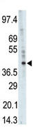 Phosphorylase Kinase Catalytic Subunit Gamma 1 antibody, AP13915PU-N, Origene, Western Blot image 