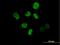 Inositol Hexakisphosphate Kinase 2 antibody, H00051447-B01P, Novus Biologicals, Immunocytochemistry image 
