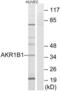 Aldose reductase antibody, LS-B9253, Lifespan Biosciences, Western Blot image 