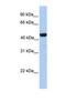 Galactose-3-O-Sulfotransferase 3 antibody, NBP1-69307, Novus Biologicals, Western Blot image 