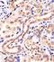 Potassium Channel Tetramerization Domain Containing 11 antibody, 61-142, ProSci, Immunohistochemistry paraffin image 