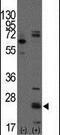 CD9 Molecule antibody, PA5-11556, Invitrogen Antibodies, Western Blot image 