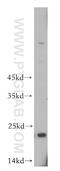 Transmembrane P24 Trafficking Protein 2 antibody, 11981-1-AP, Proteintech Group, Western Blot image 