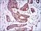 Bone Morphogenetic Protein Receptor Type 1A antibody, GTX60675, GeneTex, Immunohistochemistry paraffin image 