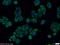 Stathmin 1 antibody, 11157-1-AP, Proteintech Group, Immunofluorescence image 