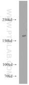 TSC Complex Subunit 2 antibody, 20004-1-AP, Proteintech Group, Western Blot image 