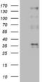 Protein C Receptor antibody, LS-C339625, Lifespan Biosciences, Western Blot image 