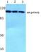 Androgen Receptor antibody, PA5-36782, Invitrogen Antibodies, Western Blot image 