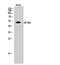 Eukaryotic Translation Initiation Factor 2B Subunit Gamma antibody, A08134, Boster Biological Technology, Western Blot image 