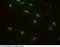 Interleukin 1 Receptor Antagonist antibody, 10123-MM02, Sino Biological, Immunohistochemistry paraffin image 
