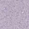 BLNK antibody, HPA038309, Atlas Antibodies, Immunohistochemistry paraffin image 