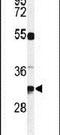 Tetraspanin 7 antibody, PA5-24801, Invitrogen Antibodies, Western Blot image 