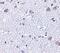 BR serine/threonine-protein kinase 1 antibody, PA5-20353, Invitrogen Antibodies, Immunohistochemistry paraffin image 