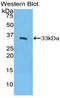 Interleukin-20 receptor subunit beta antibody, LS-C294884, Lifespan Biosciences, Western Blot image 