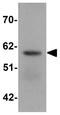 Solute Carrier Family 39 Member 5 antibody, GTX85132, GeneTex, Western Blot image 