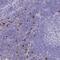 Interleukin 2 Receptor Subunit Beta antibody, NBP2-34148, Novus Biologicals, Immunohistochemistry frozen image 