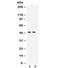 Paired Box 2 antibody, R32185, NSJ Bioreagents, Western Blot image 