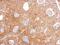 Interleukin 1 Receptor Associated Kinase 4 antibody, GTX113323, GeneTex, Immunohistochemistry paraffin image 