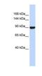 Advillin antibody, NBP1-80312, Novus Biologicals, Western Blot image 