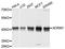 Adhesion Regulating Molecule 1 antibody, A4481, ABclonal Technology, Western Blot image 