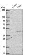 Cone-Rod Homeobox antibody, NBP1-88059, Novus Biologicals, Western Blot image 