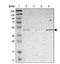 Galactosidase Alpha antibody, NBP1-89796, Novus Biologicals, Western Blot image 