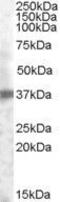 Tumor Associated Calcium Signal Transducer 2 antibody, GTX88555, GeneTex, Western Blot image 