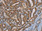 Mitochondrial Carrier 2 antibody, CSB-PA083456, Cusabio, Immunohistochemistry paraffin image 