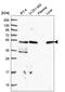 Trafficking From ER To Golgi Regulator antibody, HPA052206, Atlas Antibodies, Western Blot image 