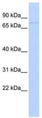 Kinesin Family Member 9 antibody, TA334711, Origene, Western Blot image 
