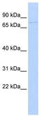 Kinesin Family Member 9 antibody, TA334711, Origene, Western Blot image 