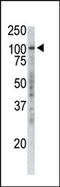 TPX2 Microtubule Nucleation Factor antibody, LS-B11806, Lifespan Biosciences, Western Blot image 