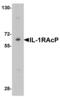 Interleukin-1 receptor accessory protein antibody, 2131, QED Bioscience, Western Blot image 