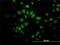 Salvador Family WW Domain Containing Protein 1 antibody, H00060485-M02, Novus Biologicals, Immunocytochemistry image 