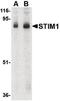 Sim antibody, PA5-20371, Invitrogen Antibodies, Western Blot image 