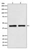 SWI/SNF Related, Matrix Associated, Actin Dependent Regulator Of Chromatin, Subfamily B, Member 1 antibody, M00500, Boster Biological Technology, Western Blot image 