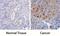 ATR Serine/Threonine Kinase antibody, AF4717, R&D Systems, Immunohistochemistry paraffin image 