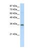 Transformer 2 Beta Homolog antibody, NBP1-57457, Novus Biologicals, Western Blot image 