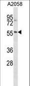 NACC Family Member 2 antibody, LS-C164735, Lifespan Biosciences, Western Blot image 