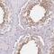 TBC1 Domain Family Member 9 antibody, HPA006503, Atlas Antibodies, Immunohistochemistry paraffin image 