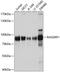 RAS guanyl-releasing protein 1 antibody, A03004, Boster Biological Technology, Western Blot image 